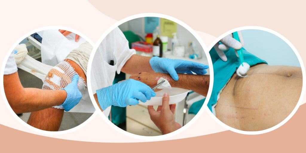 Wound Care Management at Guru Ji Healthcare Service